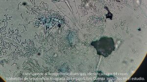 Corresponde al hongo Penicillium spp, identificado en 44 cepas obtenidas de la superficie hisopada de Legajo/Libro Cuenta incluidos en el estudio.